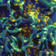 An electron micrograph of HIV particles infecting a human T cell.